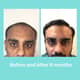 Slider image (10) Zeeva Skin & Hair Clinic
